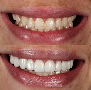 Imagem do WhatsApp de 2022-11-08 à(s) 18.21.04